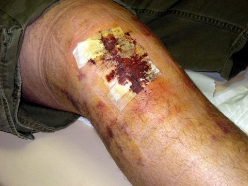 Nick_s surgery 005.jpg